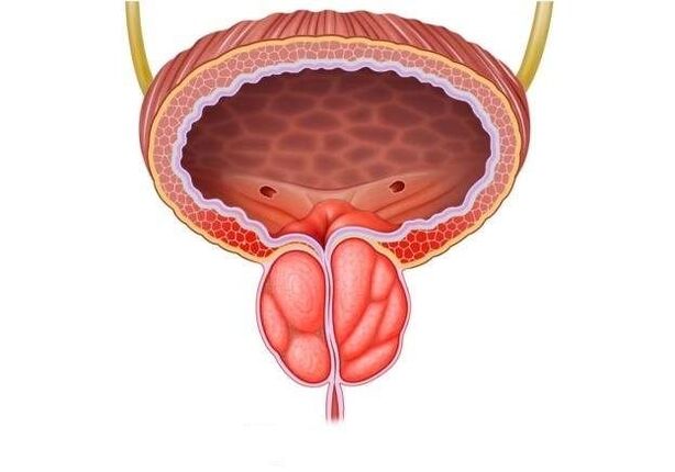 inflammation de la prostate chez les hommes