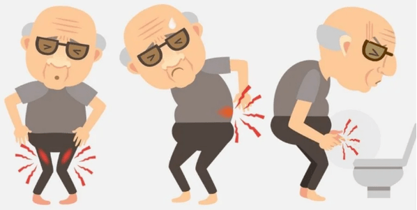 Symptômes de la prostatite