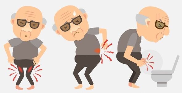symptômes de la prostatite et son traitement avec des médicaments